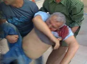 Pulluk tartışması kanlı bitti