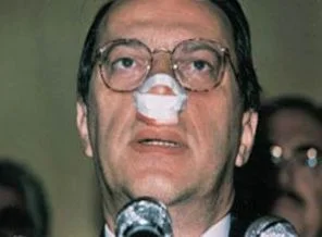 Mesut Yılmaz'ın yediği yumruğun sırrı
