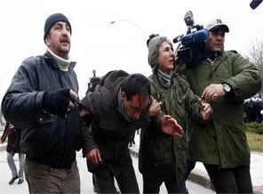 Atılan taşlar gazeteciyi bu hale getirdi