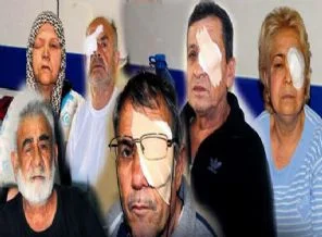 Bu nasıl bir ameliyat, hepsi kör olabilir!