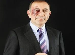 Gürsel Tekin'in gözü neden morardı?