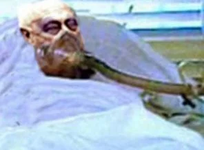 Kasap Ariel Şaron 5 yıl sonra uyandı