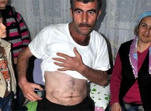 Uzaktan kumandalı ağrı kesici kabusu oldu