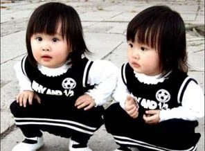 İkizler birbirini sevmeye anne karnında başlıyor