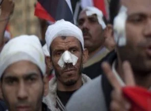 Mısırlılar taş saldırısından nasıl korunuyor?