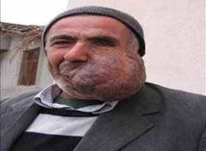 Tıp çaresiz kaldı