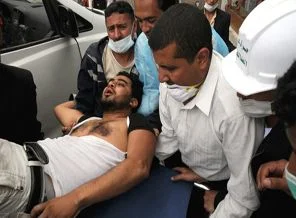 Yemen'de polis göstericilere saldırdı