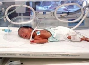Akıl almaz bir bebek kaçırma yöntemi