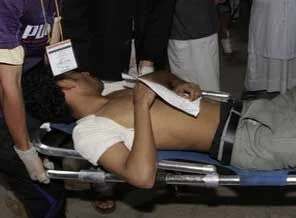 Yemen'de Salih rejimi ölüm saçıyor