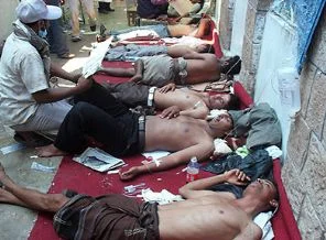Yemen polisi halkı taradı: 15 ölü