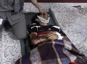 Yemen'de çatışma: 38 ölü