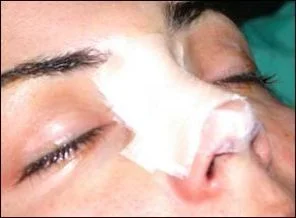 Burun estetiğinde Türkler ilk üçte