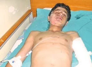 Kafasına gaz bombası isabet eden çocuk defnedildi
