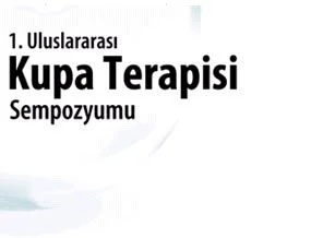 Kupa terapisi başlıyor