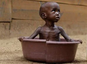 Somali ve Kenya'da açlık ve kuraklık göçe zorluyor
