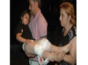 İnsan katili Pitbull'u bıçaklayarak öldürdü