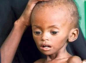 İşte BM'nin Somali raporu