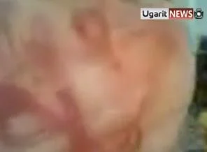 İşte Suriyeli aktivistin gördüğü işkenceler!