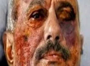 Yemen lideri Salih taburcu oldu!