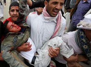 Yemen ordusu muhalifleri vurdu: 17 ölü