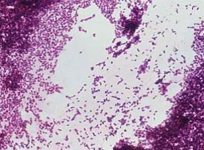 ABD'de Listeria'dan 15 kişi öldü