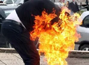 Kendini benzinle yakan öğretmen öldü