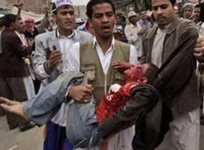 Yemen'de ölü sayısı 12'ye yükseldi