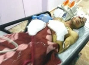 Okula atmak istediği bomba elinde patladı