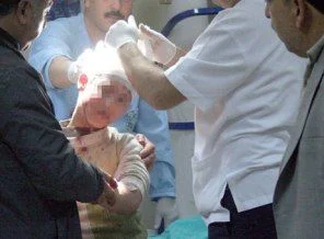 Polise atacakları bomba ellerinde patladı