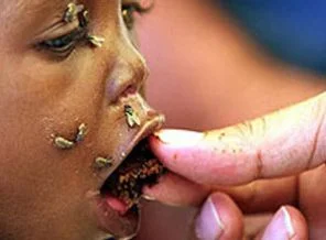 Uluslararası ödül Somali fotoğrafına