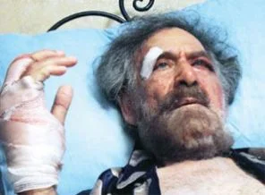 Elleri kırılan çizere ödül