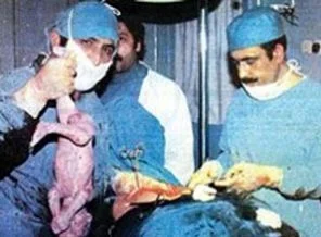 Maraş dehşetini yaşayan doktor konuştu