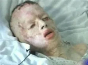 Oğulları yakılan aileye rekor tazminat