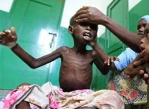 BM: Somali'yi unutmayın!