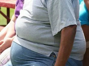 İngiltere'de obezlere hayvan muamelesi