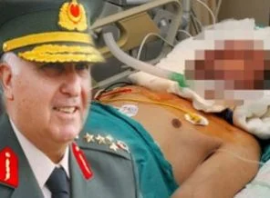 Yüz nakli TSK'nın da dikkatini çekti