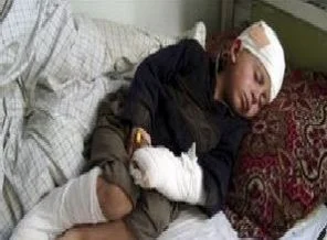Afganistan'da rekor sivil ölümleri