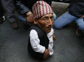 O dünyanın en kısa adamı