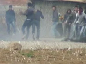 Bomba elinde patladı (Video)