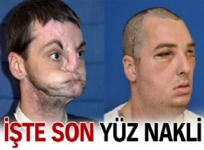 Bu da ABD'nin yüz nakli