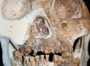Yeni bir insan türü bulundu