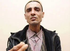 Kafasında 40 iğneyle dolaşıyor