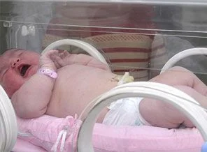 Obezite ile mücadele anne karnında başlıyor