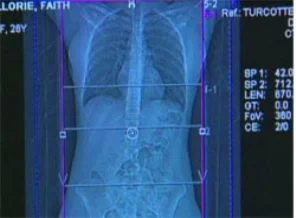 Bel ağrısı iç organlardaki hastalıkların belirtisi olabilir