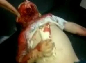 Esed güçleri çocukları katlediyor (Video)