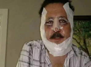 Gökhan Güney estetik kurbanı oldu