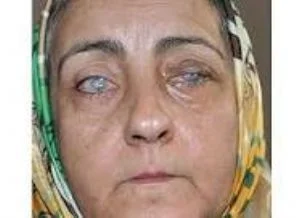 Gözyaşlarını tükürük bezleri akıtacak