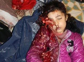 Suriye'deki olaylarda 21 kişi öldü