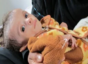 Yemen'de felakete az kaldı