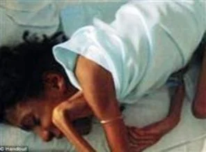 Annesi aç bıraktı 10 kiloya düştü